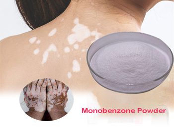 Does Monobenzone Lighten Skin？